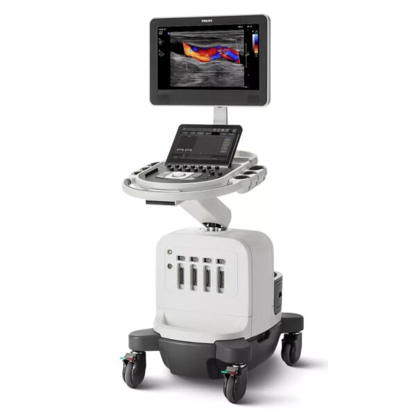 Sistem ecografie Philips Affiniti 50